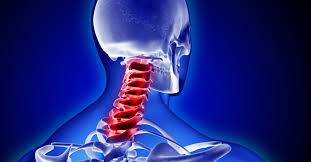 thoái hóa đốt sống cổ